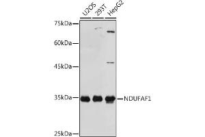 Western blot analysis of extracts of various cell lines, using NDUF Rabbit mAb (ABIN1681278, ABIN3018403, ABIN3018404 and ABIN7101607) at 1:1000 dilution.