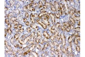 IHC analysis of Thrombopoietin using anti- Thrombopoietin antibody .