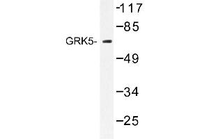 Image no. 1 for anti-G Protein-Coupled Receptor Kinase 5 (GRK5) antibody (ABIN272181) (GRK5 anticorps)