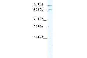 WB Suggested Anti-MTA2 Antibody Titration:  5. (MTA2 anticorps  (Middle Region))