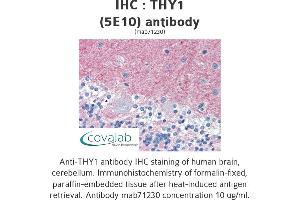 Image no. 3 for anti-CD90 (THY1) antibody (ABIN1724058) (CD90 anticorps)