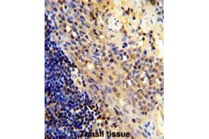 Formalin-fixed and paraffin-embedded human tonsilreacted with CD8A polyclonal antibody , which was peroxidase-conjugated to the secondary antibody, followed by AEC staining. (CD8 alpha anticorps  (N-Term))