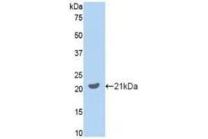 WB of Protein Standard: different control antibodies  against Highly purified E. (GAS6 Kit ELISA)