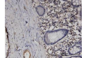 anti-Proline Rich Gla (G-Carboxyglutamic Acid) 1 (PRRG1) (AA 22-81) antibody