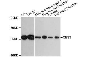 Western blot analysis of extracts of various cell lines, using CES3 antibody. (CES3 anticorps  (AA 269-568))