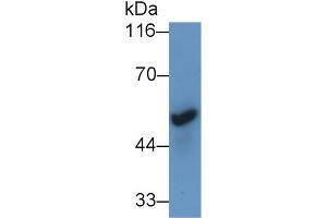 Detection of CHRNa7 in Mouse Cerebrum lysate using Polyclonal Antibody to Cholinergic Receptor, Nicotinic, Alpha 7 (CHRNa7)