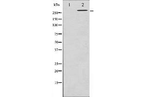 Western blot analysis of Filamin A phosphorylation expression in EGF treated 293 whole cell lysates,The lane on the left is treated with the antigen-specific peptide.