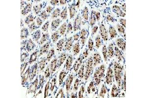 IHC analysis of SP6 using anti-SP6 antibody (ABIN5692945). (SP6 anticorps)