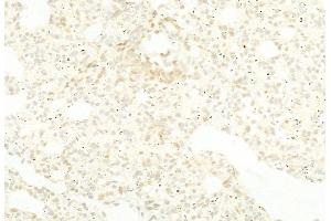 ABIN6264260 and ABIN6268782 at 1/100 staining Rat lung tissue by IHC-P. (PKM2 anticorps  (Internal Region))