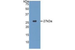 Detection of Recombinant GSTa4, Human using Polyclonal Antibody to Glutathione S Transferase A4 (GSTA4)