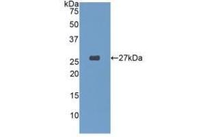 Detection of Recombinant GSTa4, Human using Polyclonal Antibody to Glutathione S Transferase A4 (GSTA4) (GSTA4 anticorps  (AA 3-222))