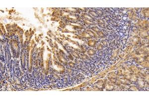 Detection of PKM2 in Mouse Colon Tissue using Polyclonal Antibody to Pyruvate kinase isozymes M2 (PKM2)
