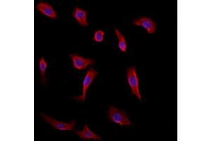 ABIN6260440 and ABIN6272875 staining HepG2 by IF/ICC. (CAMSAP2 anticorps  (C-Term))