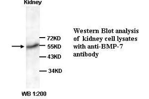 Image no. 1 for anti-Bone Morphogenetic Protein 7 (BMP7) (C-Term) antibody (ABIN791031) (BMP7 anticorps  (C-Term))
