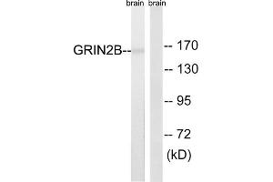 Western blot analysis of extracts from mouse brain cells, using GRIN2B (epitope around residue 1303) antibody. (GRIN2B anticorps  (Ser1303))