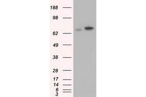 Western Blotting (WB) image for anti-Heat Shock 70kDa Protein 1A (HSPA1A) antibody (ABIN1498743)