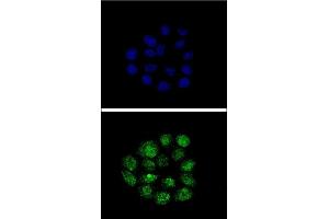 Confocal immunofluorescent analysis of TIEG2 Antibody (N-term) (ABIN390561 and ABIN2840892) with Hela cell followed by Alexa Fluor® 488-conjugated goat anti-rabbit lgG (green). (KLF11 anticorps  (N-Term))