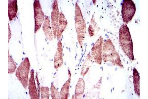 Immunohistochemical analysis of paraffin-embedded muscle tissues using RPS6KB1 mouse mAb with DAB staining.