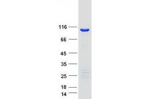 Validation with Western Blot