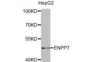 Western blot analysis of extracts of HepG2 cells, using ENPP7 antibody (ABIN5971506) at 1:400 dilution. (ENPP7 anticorps)