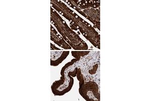 Immunohistochemical staining of human gallbladder with KIAA0753 polyclonal antibody  strong cytoplasmic positivity in glandular cells at 1:50-1:200 dilution. (KIAA0753 anticorps)