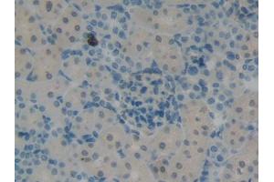 DAB staining on IHC-P; Samples: Rat Kidney Tissue (KRT12 anticorps  (AA 398-456))