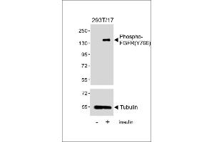 Western blot analysis of lysates from 293T/17 cell line, untreated or treated with insulin(0. (FGFR (pTyr766) anticorps)