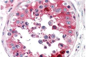 Human Testis (formalin-fixed, paraffin-embedded) stained with CLU antibody ABIN307177 at 5 ug/ml followed by biotinylated anti-mouse IgG secondary antibody ABIN481714, alkaline phosphatase-streptavidin and chromogen. (Clusterin anticorps)