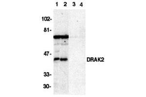 Western Blotting (WB) image for anti-serine/threonine Kinase 17b (STK17B) (C-Term) antibody (ABIN1030368) (DRAK2 anticorps  (C-Term))