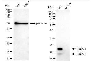 Western blotting analysis using MAP1LC3A antibody (ABIN7799409). (Recombinant MAP1LC3A anticorps)