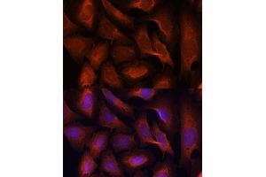 Immunofluorescence analysis of U-2 OS cells using M antibody (ABIN3023031, ABIN3023032, ABIN3023033, ABIN1513170 and ABIN6219356) at dilution of 1:100.