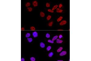 Confocal immunofluorescence analysis of U2OS cells using CPSF6 Polyclonal Antibody (ABIN6128924, ABIN6138974, ABIN6138975 and ABIN6221646) at dilution of 1:100.