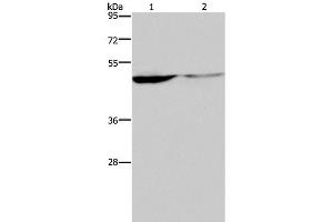 Western Blot analysis of Human paraneoplastic and normal kidney tissue using KCNK9 Polyclonal Antibody at dilution of 1:650 (KCNK9 anticorps)