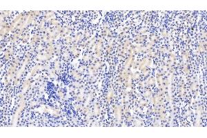 Detection of DTYMK in Mouse Kidney Tissue using Monoclonal Antibody to Deoxythymidylate Kinase (DTYMK) (DTYMK anticorps  (AA 43-190))