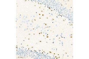 Immunohistochemistry of paraffin embedded mouse brain using SOX1 (ABIN7075712) at dilution of 1:2000 (300x lens)