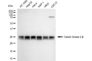 Western blotting analysis using Casein kinase 2 beta antibody (ABIN7797883). (Recombinant CSNK2B anticorps)