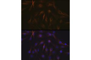 Immunofluorescence analysis of C6 cells using Tubulin beta-1 chain Rabbit mAb (ABIN7271045) at dilution of 1:100 (40x lens).