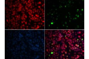 Immunofluorescence analysis of GFP-RNF168 transgenic U2OS cells using MPG antibody. (MPG anticorps  (AA 1-293))