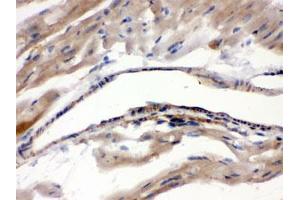 IHC testing of FFPE mouse heart with MAOA antibody.