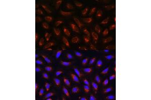Immunofluorescence analysis of U-2 OS cells using MRPL43 antibody (ABIN7268573) at dilution of 1:100. (MRPL43 anticorps  (AA 80-155))