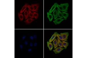 ABIN6265013 and ABIN6279108 staining Hela cells by IF/ICC.
