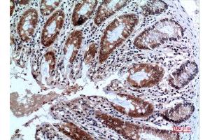 Immunohistochemistry (IHC) analysis of paraffin-embedded Human Colon, antibody was diluted at 1:100. (FOXP3 anticorps  (C-Term))