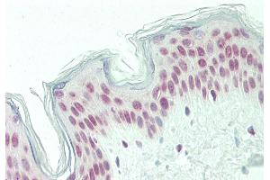 Rabbit Anti-PQBP1 antibody  Formalin Fixed Paraffin Embedded Tissue: Human Skin Primary antibody Concentration: 1:100 Secondary Antibody: Donkey anti-Rabbit-Cy3 Secondary Antibody Concentration: 1:200 Magnification: 20x Exposure Time: 0.