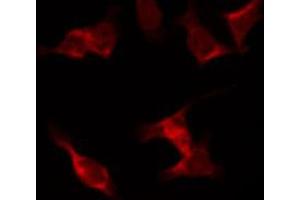 ABIN6267441 staining NIH-3T3 by IF/ICC.