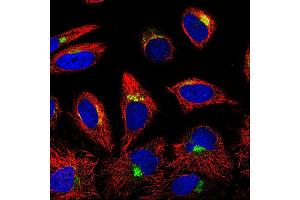 Image no. 1 for anti-Insulin-Like Growth Factor Binding Protein 7 (IGFBP7) antibody (ABIN181542)