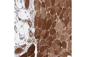Immunohistochemical staining of human skeletal muscle with PFKM polyclonal antibody  shows strong cytoplasmic positivity in myocytes at 1:20-1:50 dilution. (PFKM anticorps)