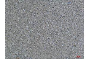 Immunohistochemistry (IHC) analysis of paraffin-embedded Human Brain Tissue using a-tubulin(Acetyl Lys40) Mouse Monoclonal Antibody diluted at 1:200.