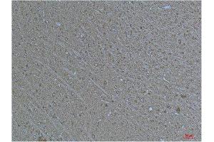 Immunohistochemistry (IHC) analysis of paraffin-embedded Human Brain Tissue using a-tubulin(Acetyl Lys40) Mouse Monoclonal Antibody diluted at 1:200.