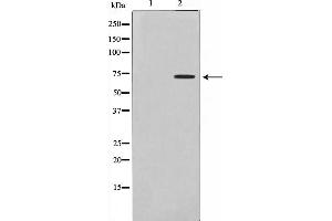 Western blot analysis on Jurkat cell lysate using DMPK Antibody,The lane on the left is treated with the antigen-specific peptide.