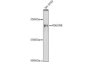 Western blot analysis of extracts of SH-SY5Y cells, using PDGFRB antibody (ABIN6134579, ABIN6145372 and ABIN7101437) at 1:1000 dilution. (PDGFRB anticorps)